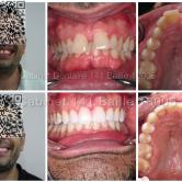 ofrthodontie invisalign® marseille Cabinet 141 Baille